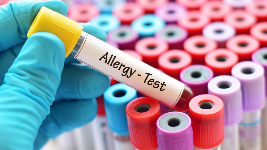 allergy-test-sample