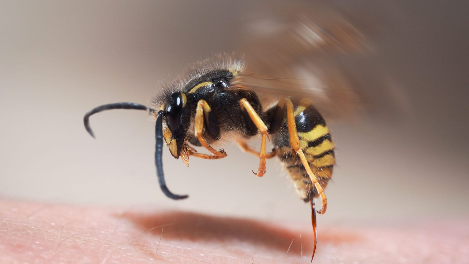 wasp sting
